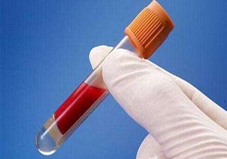 稀释液渗透压改变对血常规检测结果影响的研究